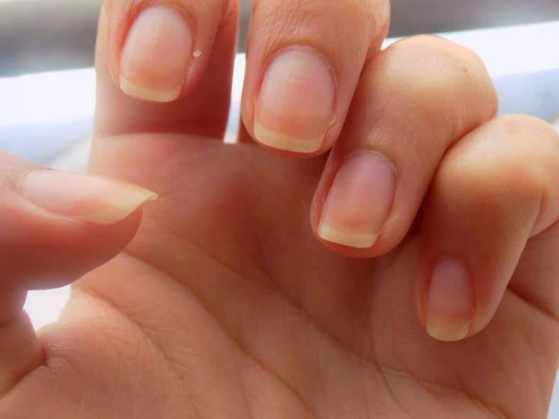 Remèdes Maison pour les Ongles Jaunes Vernis semi permanent