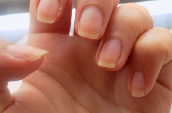 Remèdes Maison pour les Ongles Jaunes